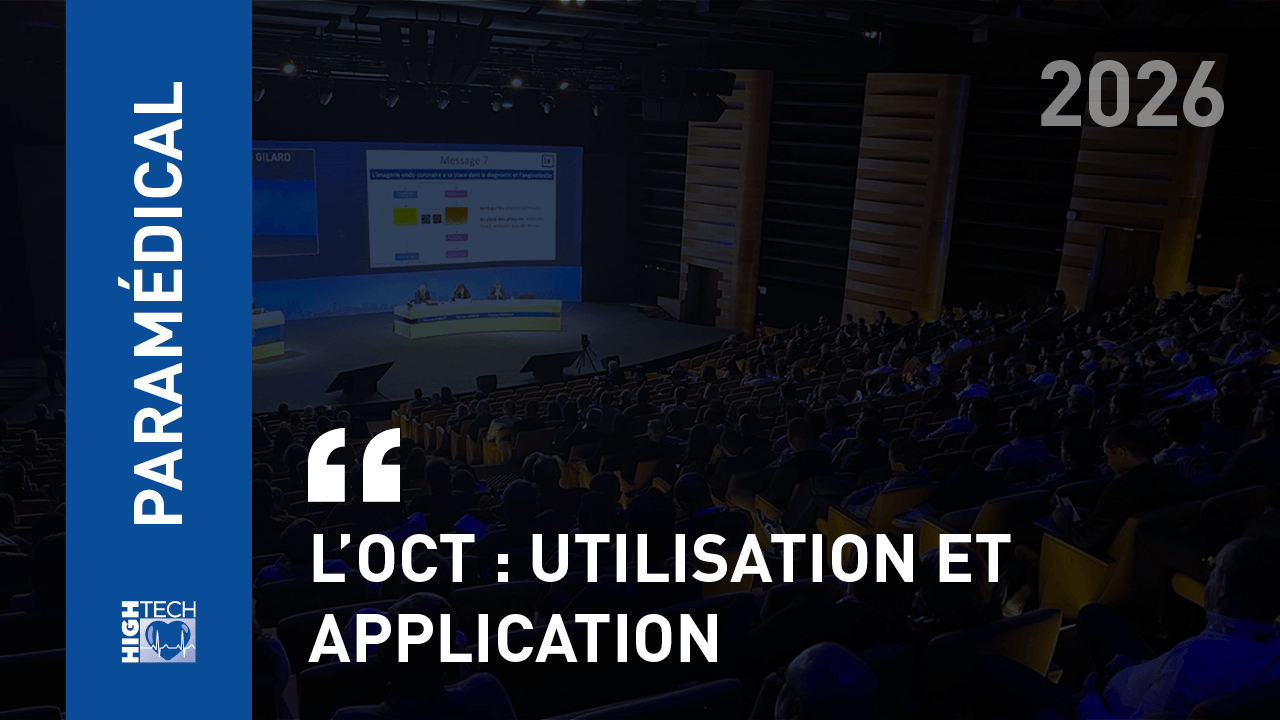 L’OCT : utilisation et application – Clément Marquet