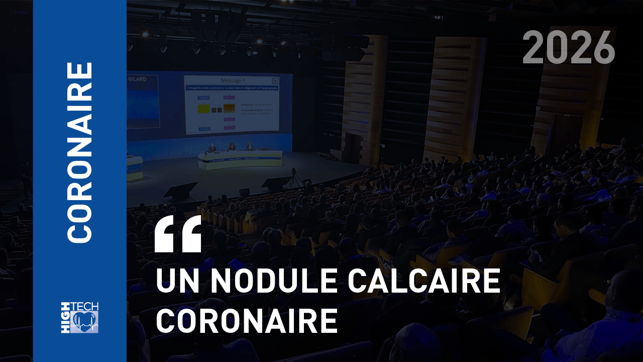 Un nodule calcaire coronaire – Pierre Deharo