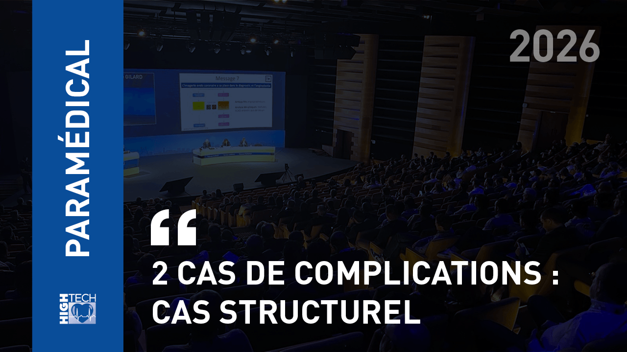 2 cas de complications : cas structurel – Florent Chery